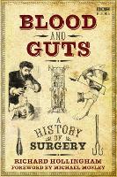 Blood and Guts: A History of Surgery