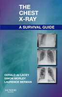 The Chest X-Ray: A Survival Guide (ePub eBook)