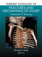 Forensic Pathology of Fractures and Mechanisms of Injury: Postmortem CT Scanning