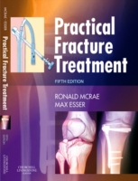Practical Fracture Treatment E-Book: Practical Fracture Treatment E-Book (ePub eBook)